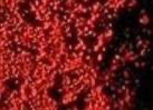 Cochenille Cochenille
