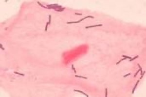 Lactobacillus acidophilus